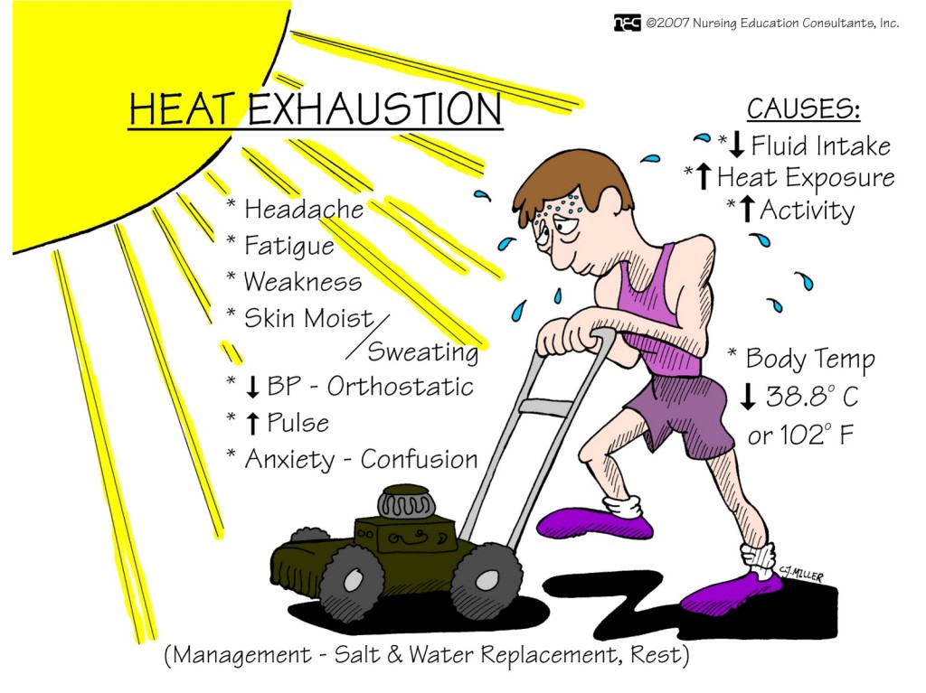 Heat Exhaustion Leg Cramps at Carol Vogelsang blog