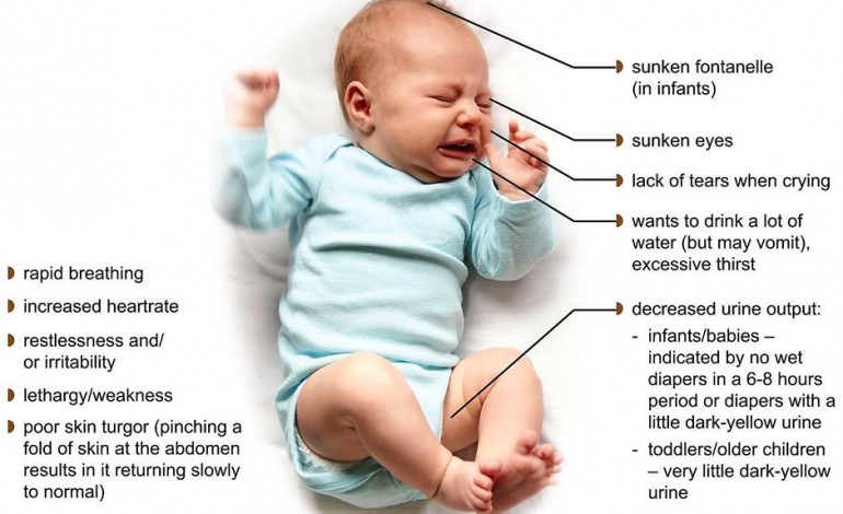 signs of dehydration in babies