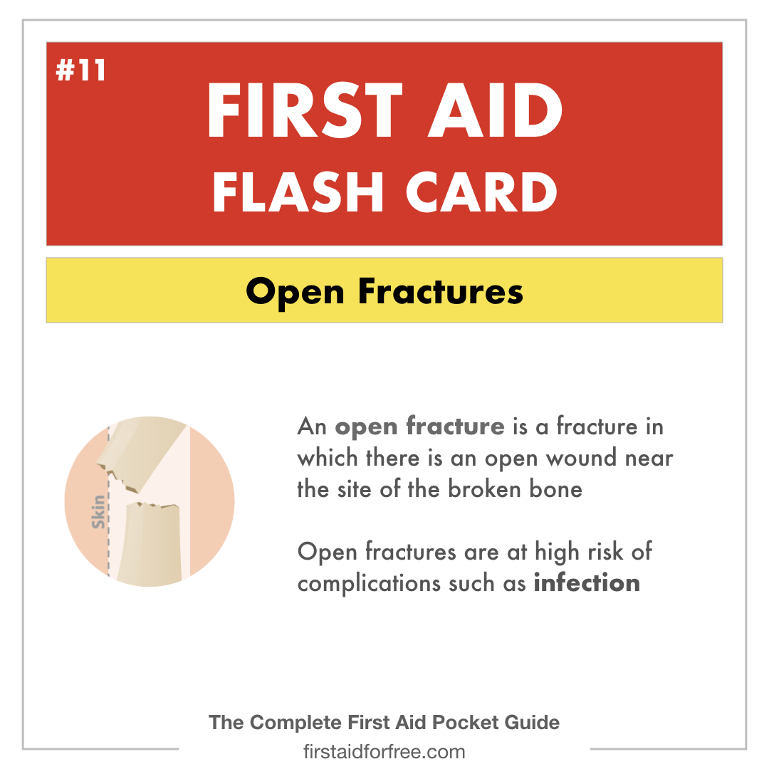 First Aid For Fractures And Sprains