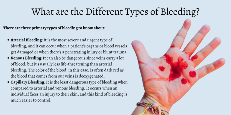 What Are The Different Types of Bleeding in First Aid?