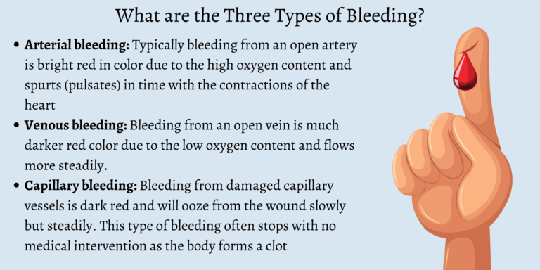 What are the Three Types of Bleeding? - First Aid for Free