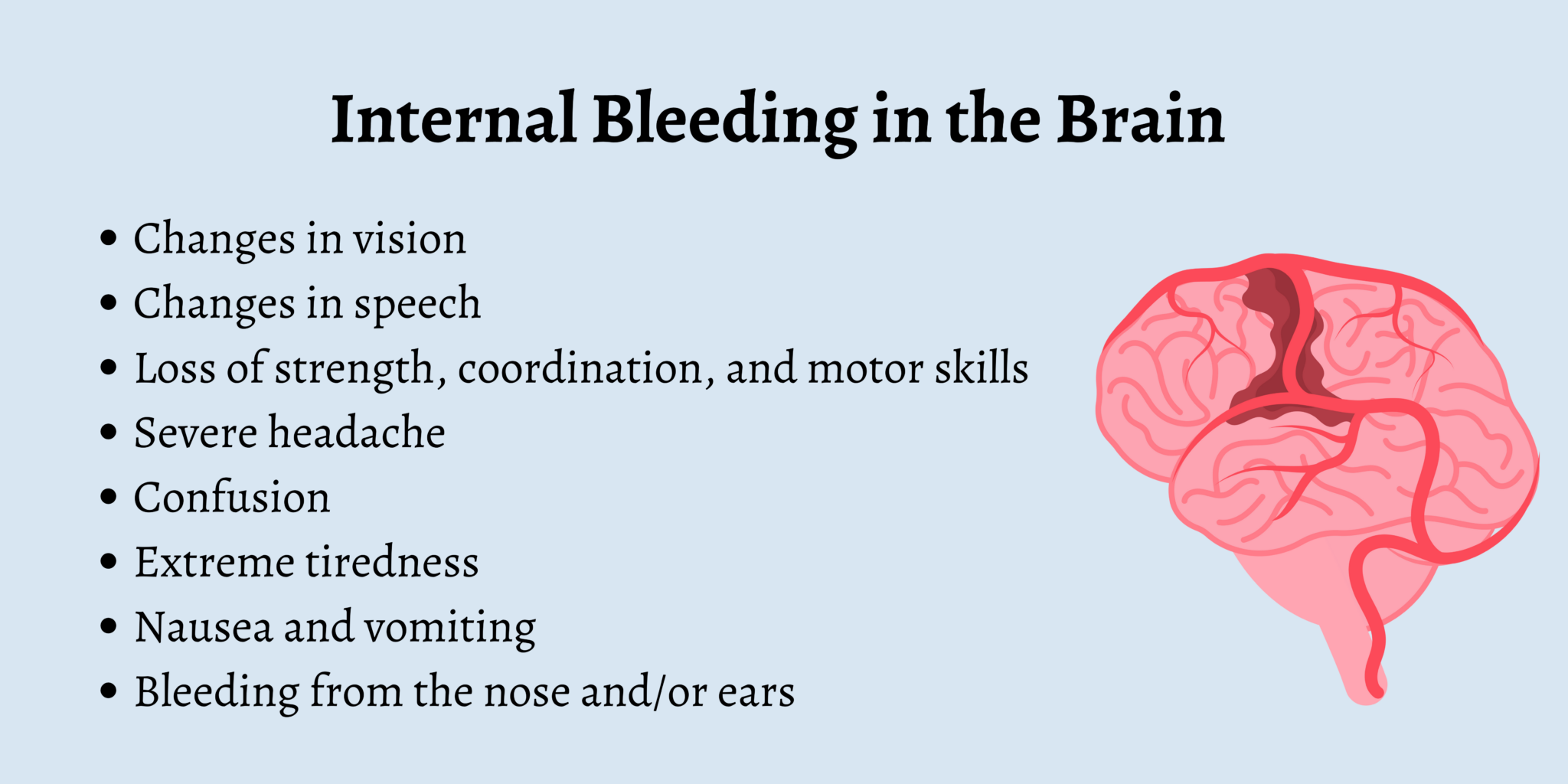 first-aid-for-internal-bleeding-first-aid-for-free