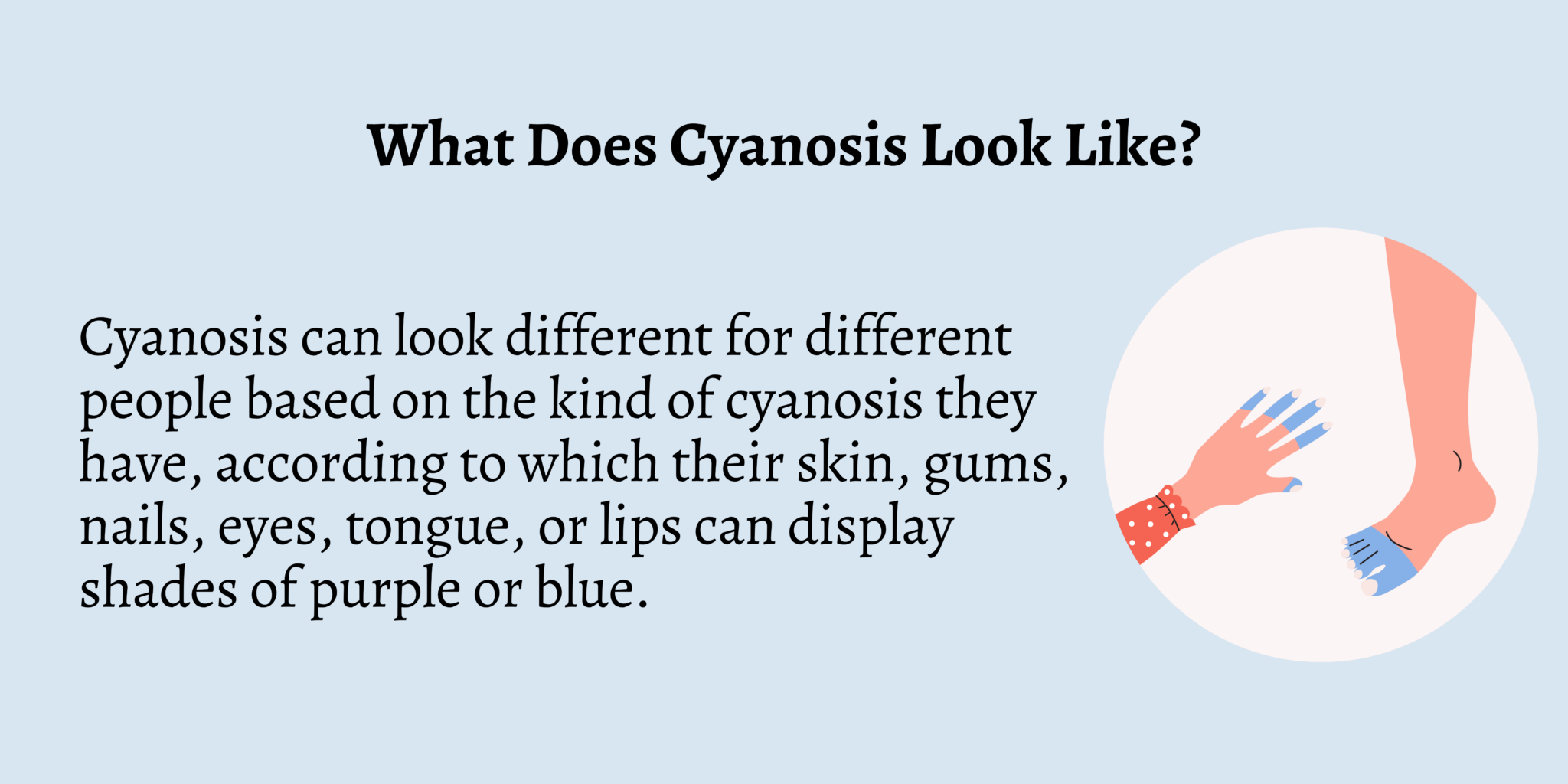 Is Cyanosis An Emergency First Aid For Free