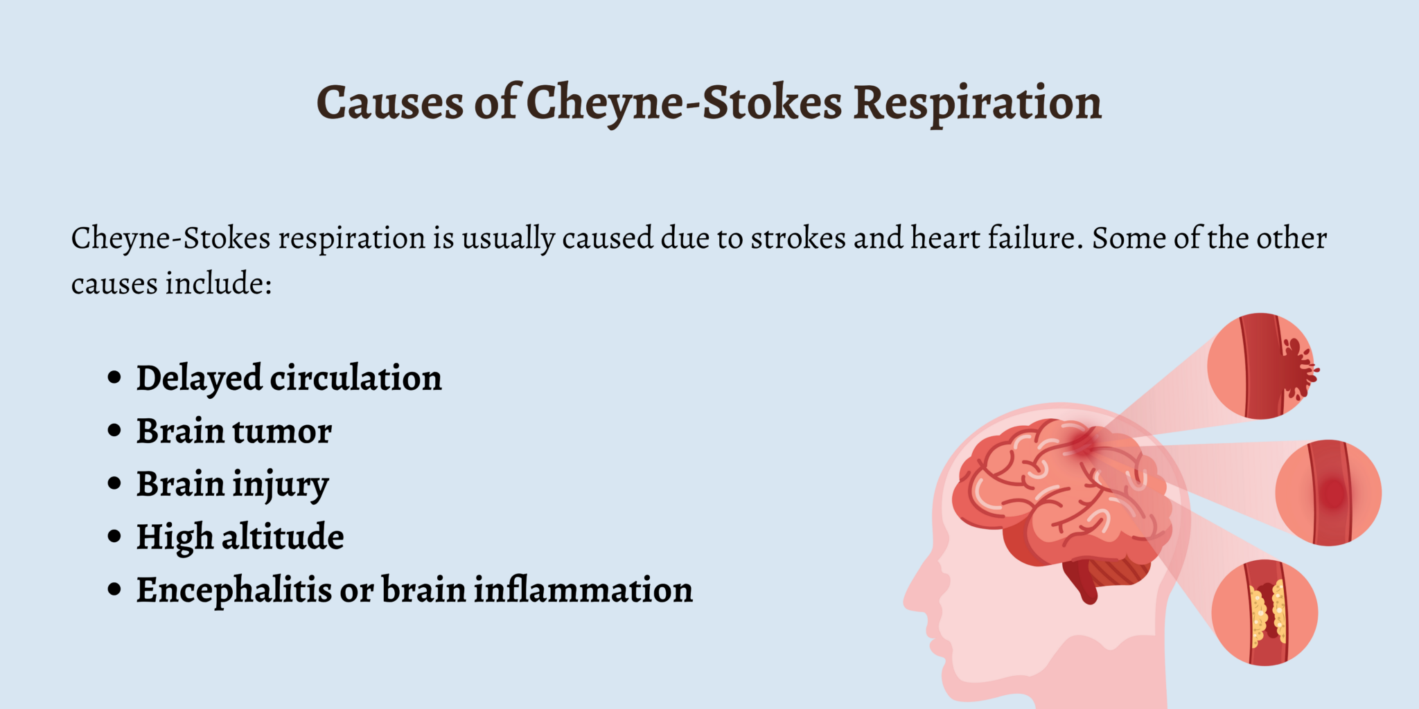 Causes Of Cheyne Stokes Respiration 2048x1024 