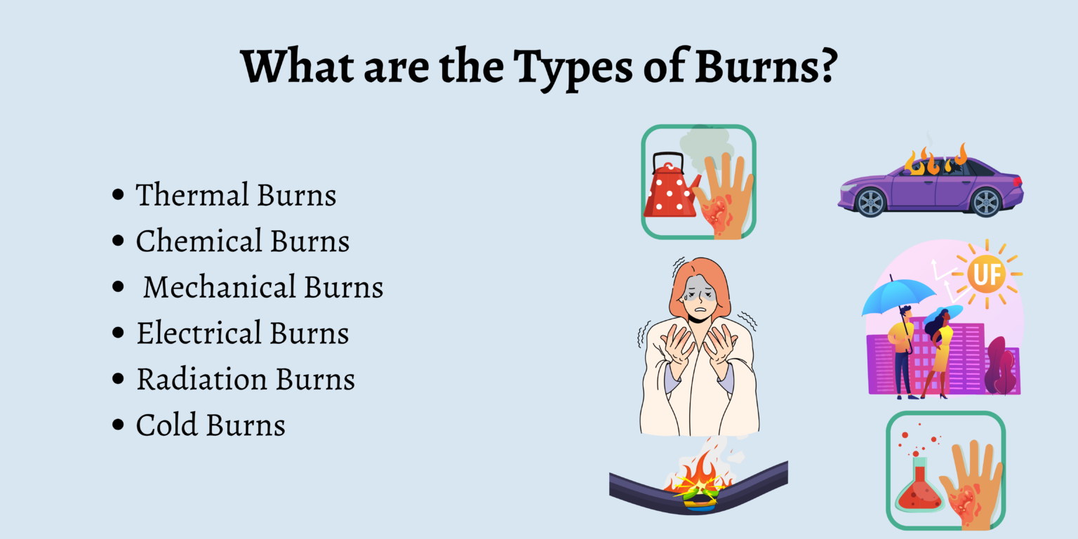 What Are The Different Types Of Burn Injuries 9209