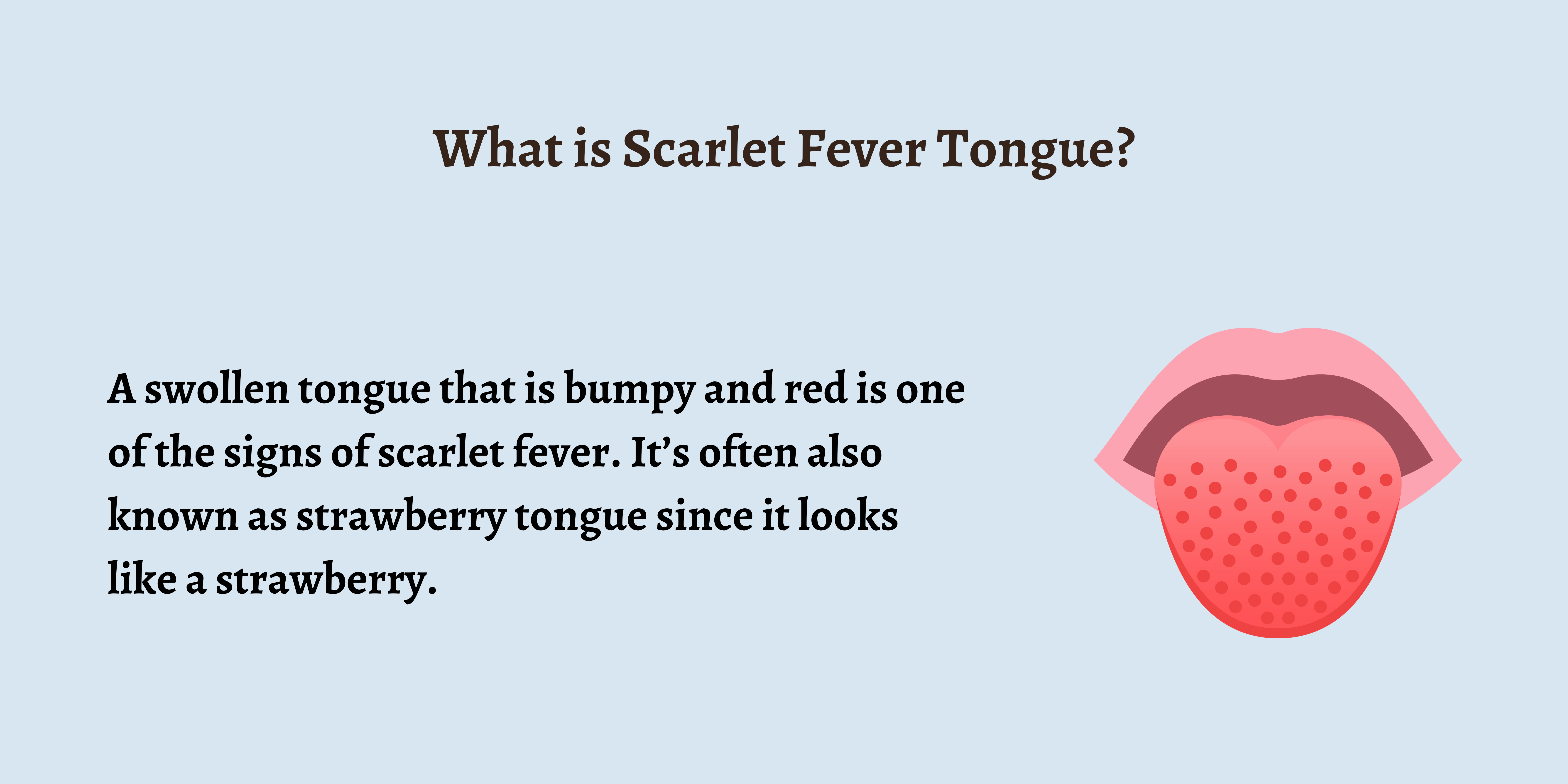 <Scarlet fever>